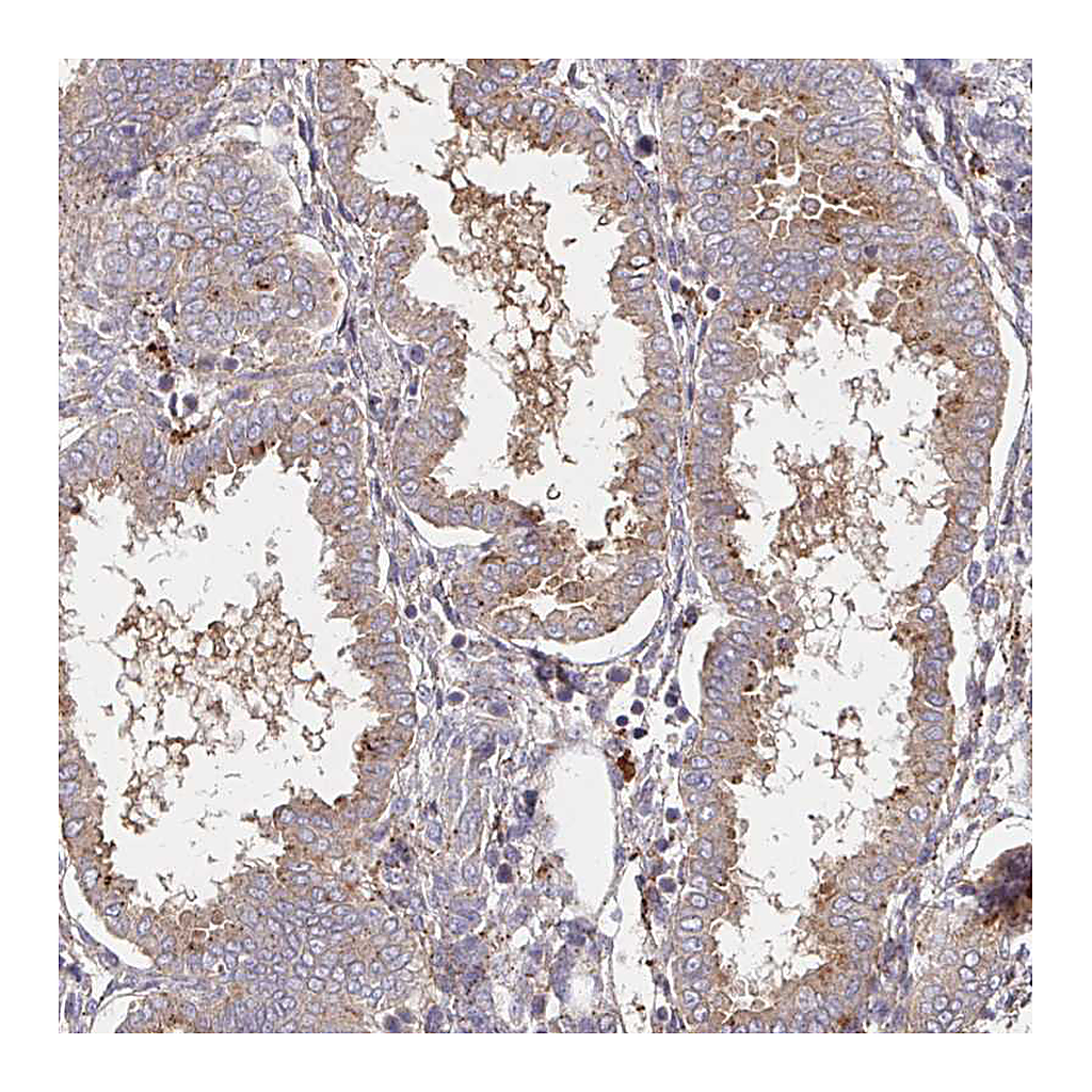 Atlas Antibodies Anti-IDUA Antibody