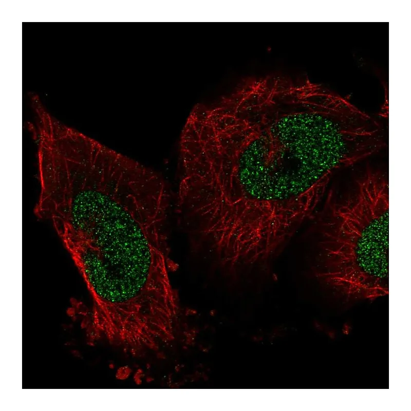 Atlas Antibodies Anti-IER2 Antibody