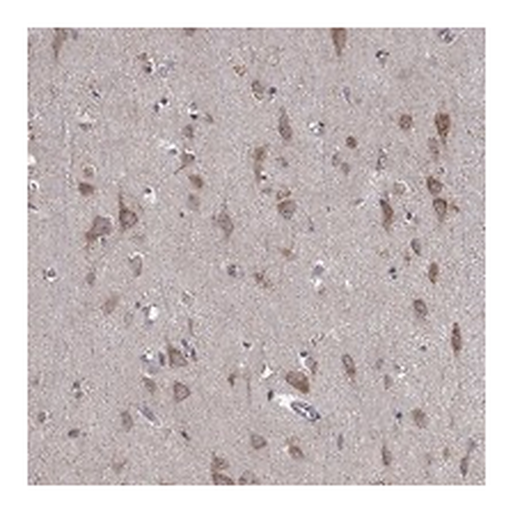 Atlas Antibodies Anti-IDS Antibody