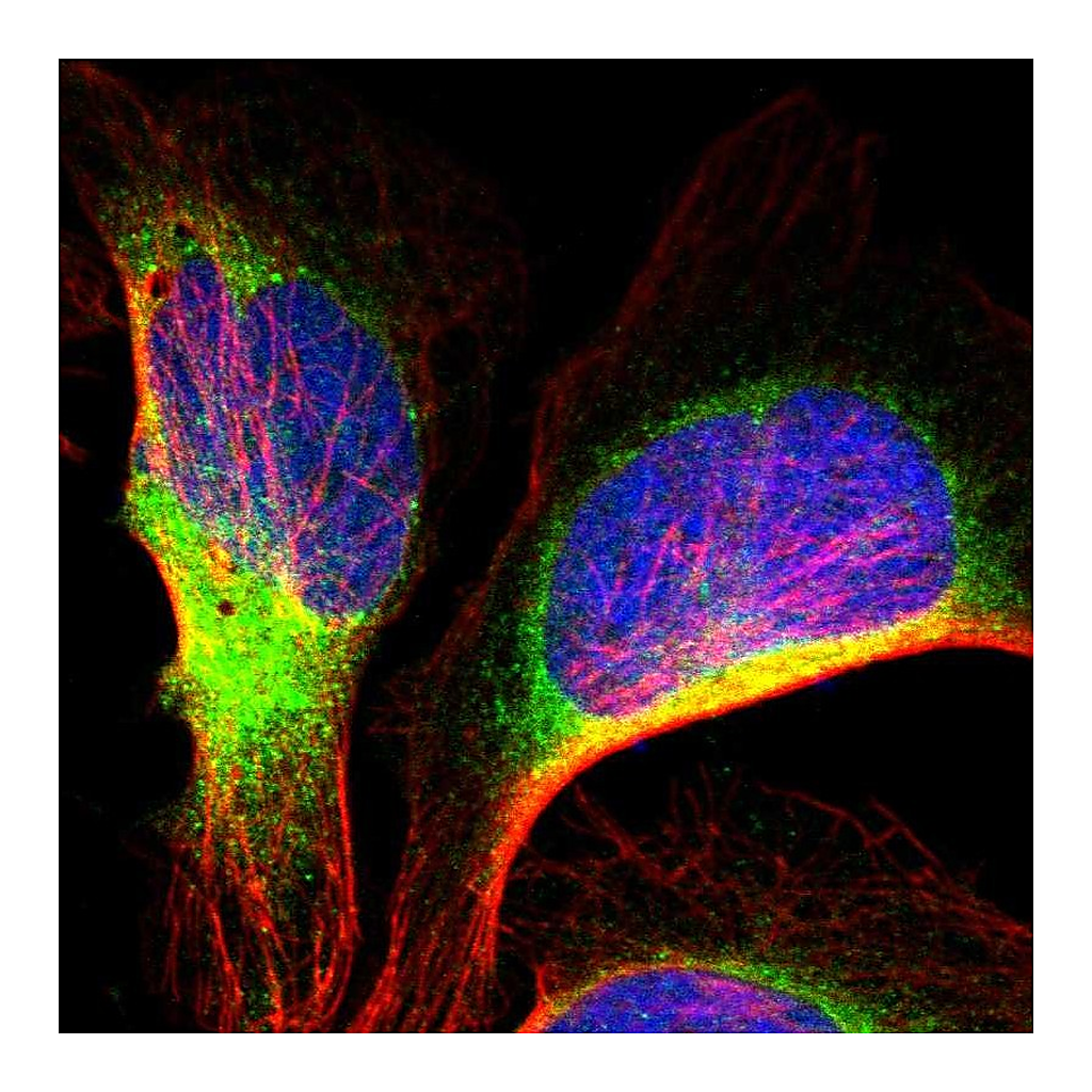 Atlas Antibodies Anti-IER3IP1 Antibody