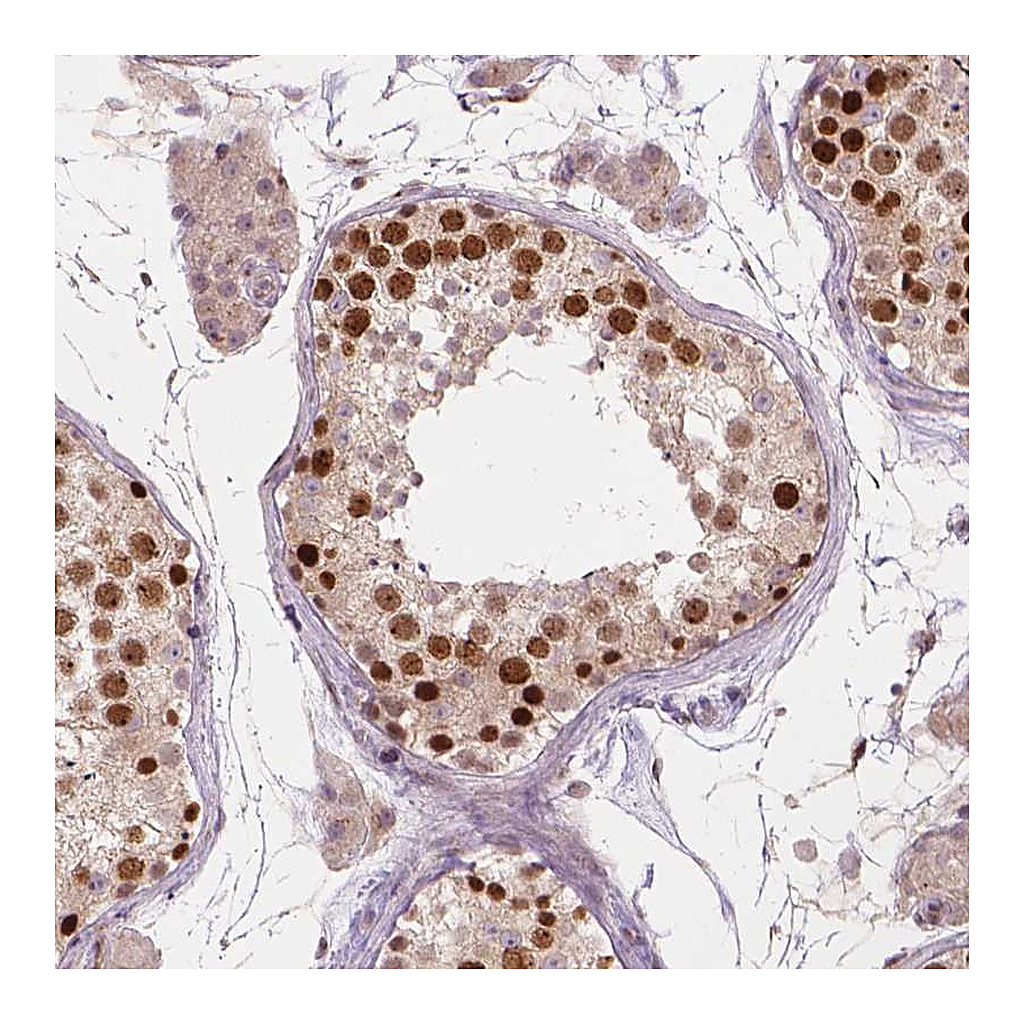 Atlas Antibodies Anti-IFFO1 Antibody