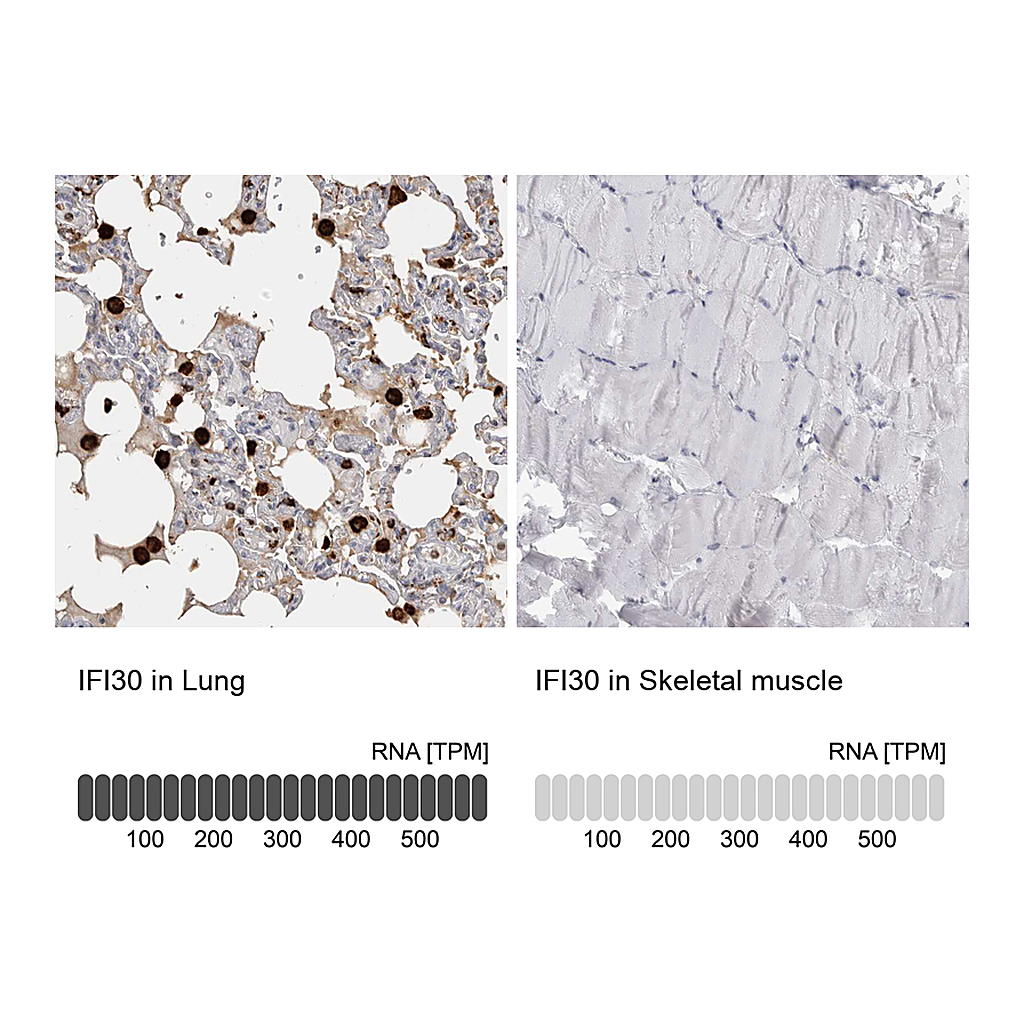 Atlas Antibodies Anti-IFI30 Antibody