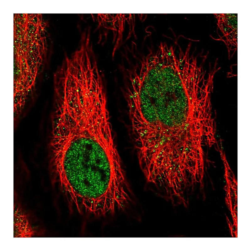 Atlas Antibodies Anti-IFI44 Antibody