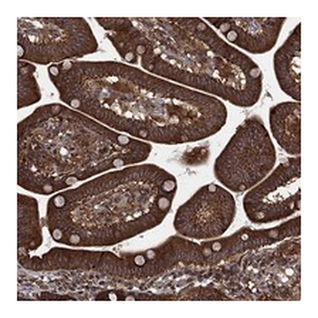 Atlas Antibodies Anti-IFI35 Antibody