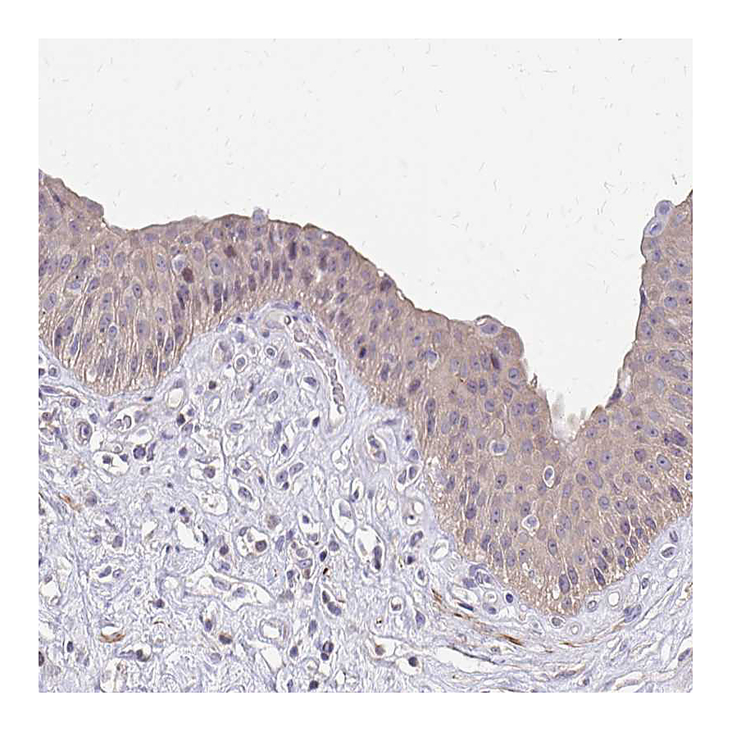 Atlas Antibodies Anti-IFI44L Antibody