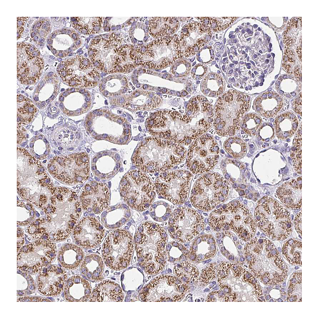 Atlas Antibodies Anti-IFIT1 Antibody