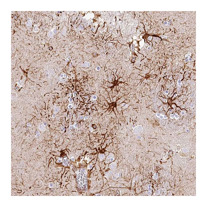 Atlas Antibodies Anti-IFIT5 Antibody