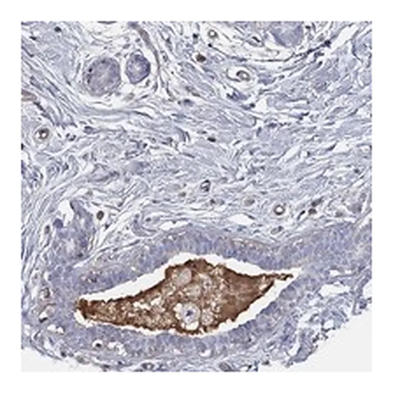 Atlas Antibodies Anti-IFNB1 Antibody