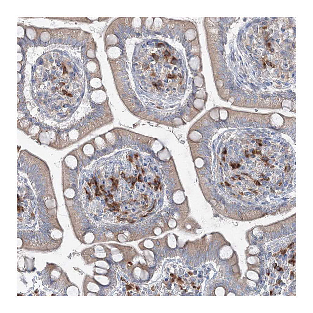 Atlas Antibodies Anti-IFNAR1 Antibody