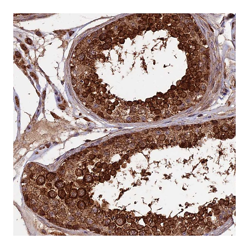 Atlas Antibodies Anti-IFT22 Antibody