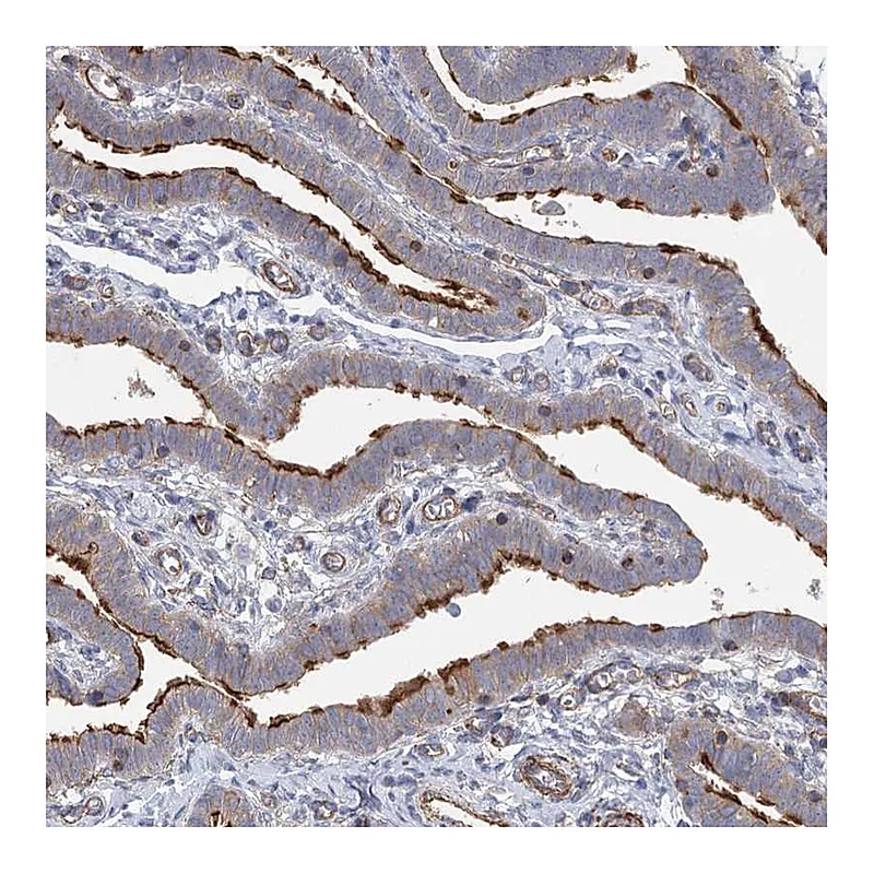 Atlas Antibodies Anti-IFT46 Antibody