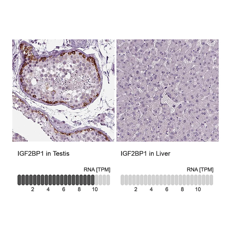 Atlas Antibodies Anti-IGF2BP1 Antibody