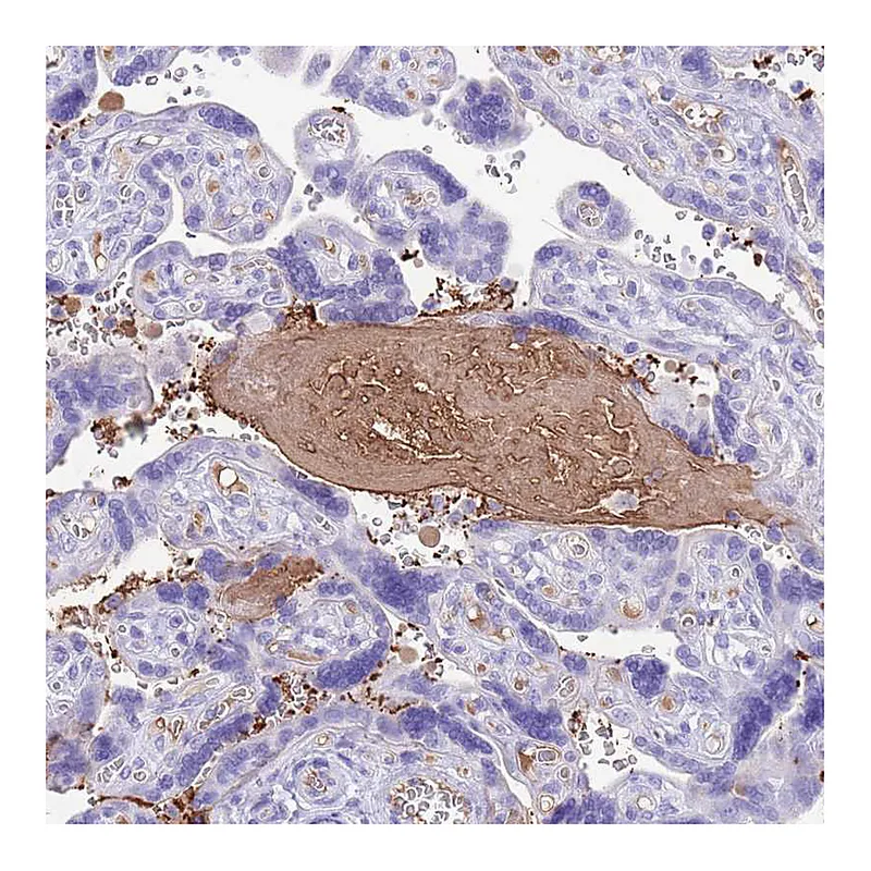 Atlas Antibodies Anti-IGF1 Antibody