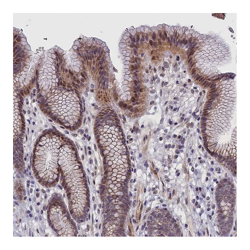 Atlas Antibodies Anti-IGFALS Antibody