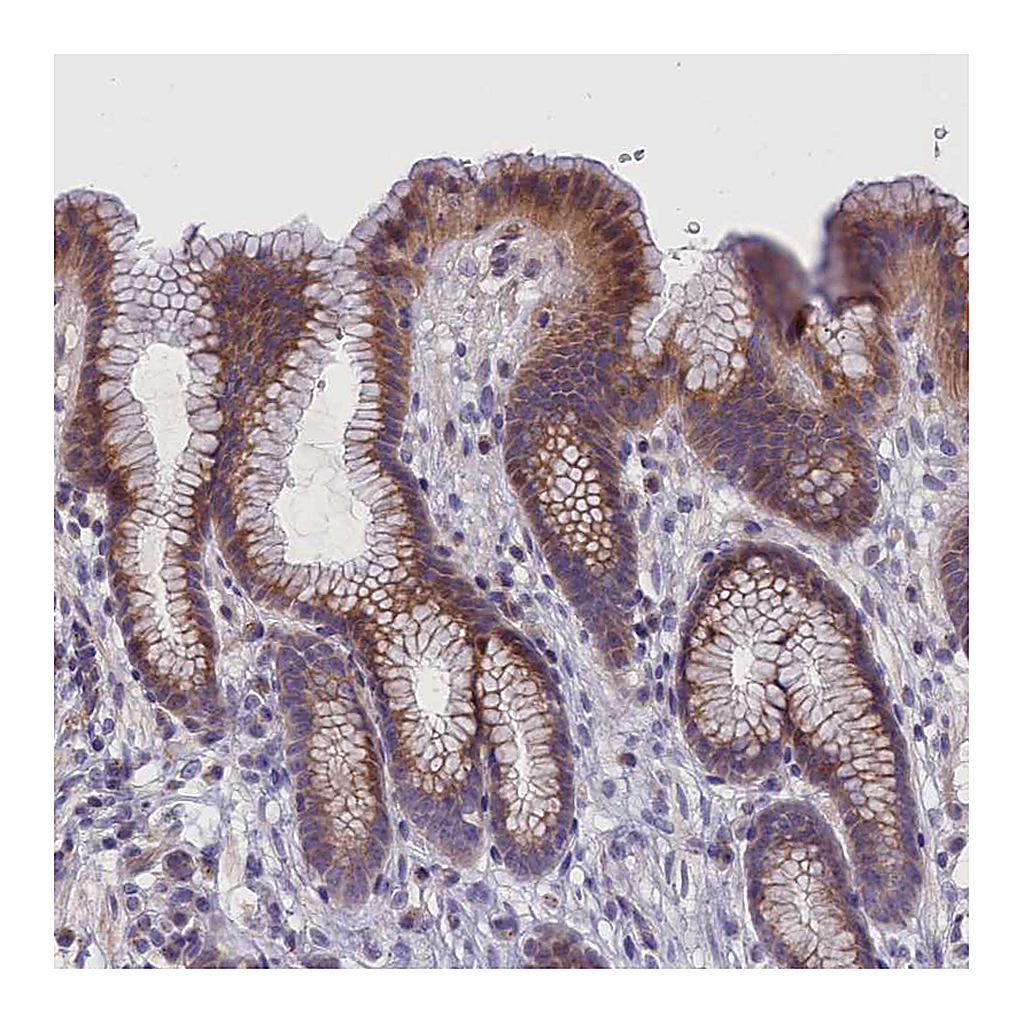Atlas Antibodies Anti-IGFALS Antibody
