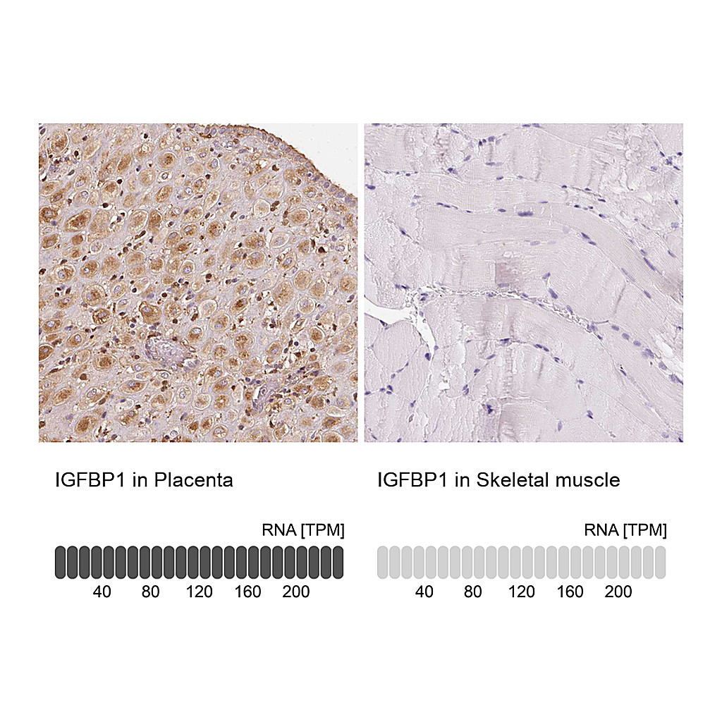 Atlas Antibodies Anti-IGFBP1 Antibody