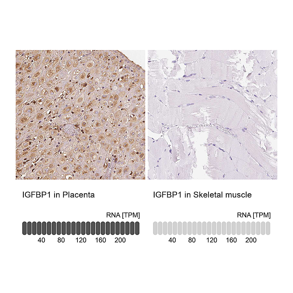 Atlas Antibodies Anti-IGFBP1 Antibody