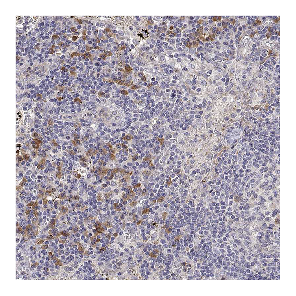 Atlas Antibodies Anti-IGFBP4 Antibody