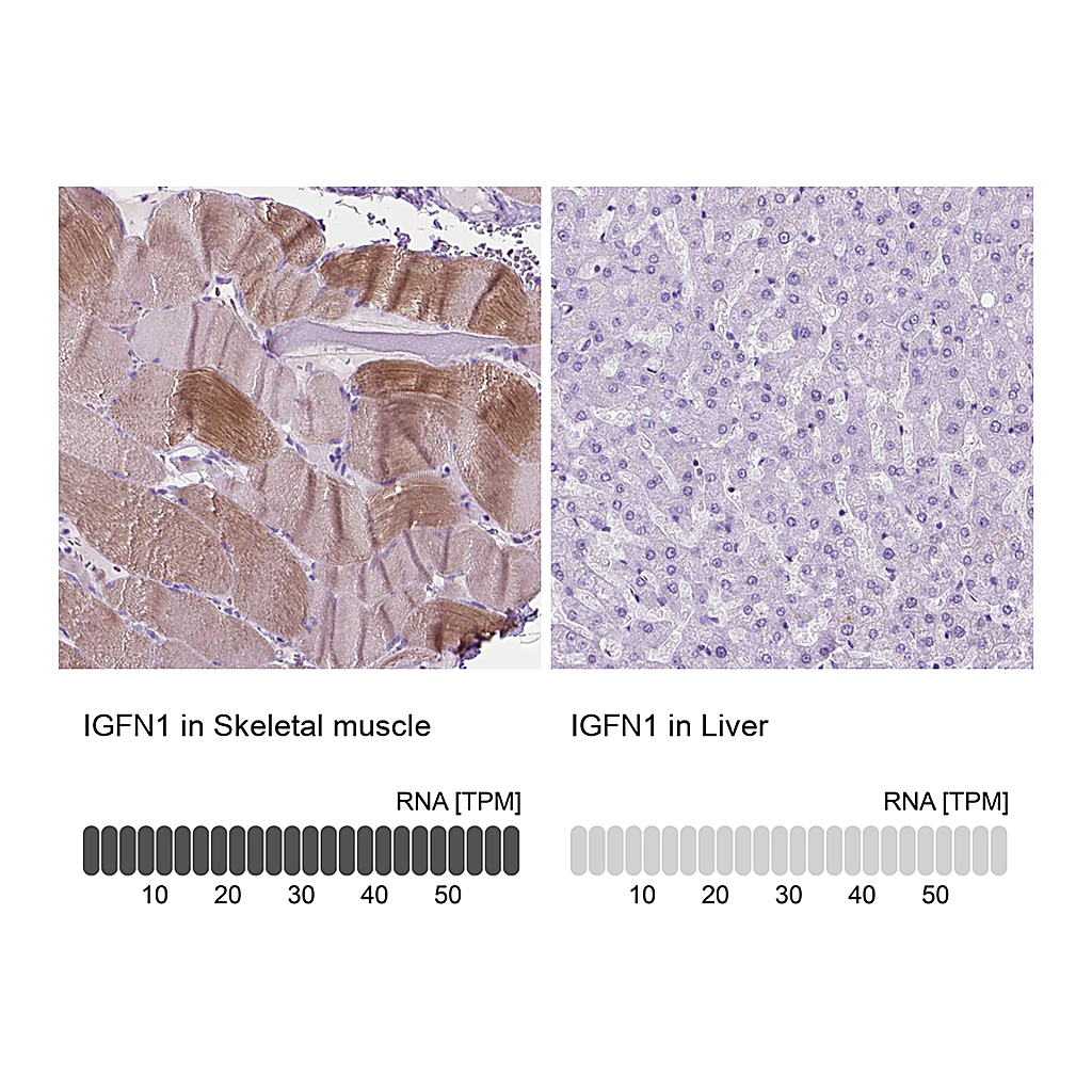 Atlas Antibodies Anti-IGFN1 Antibody