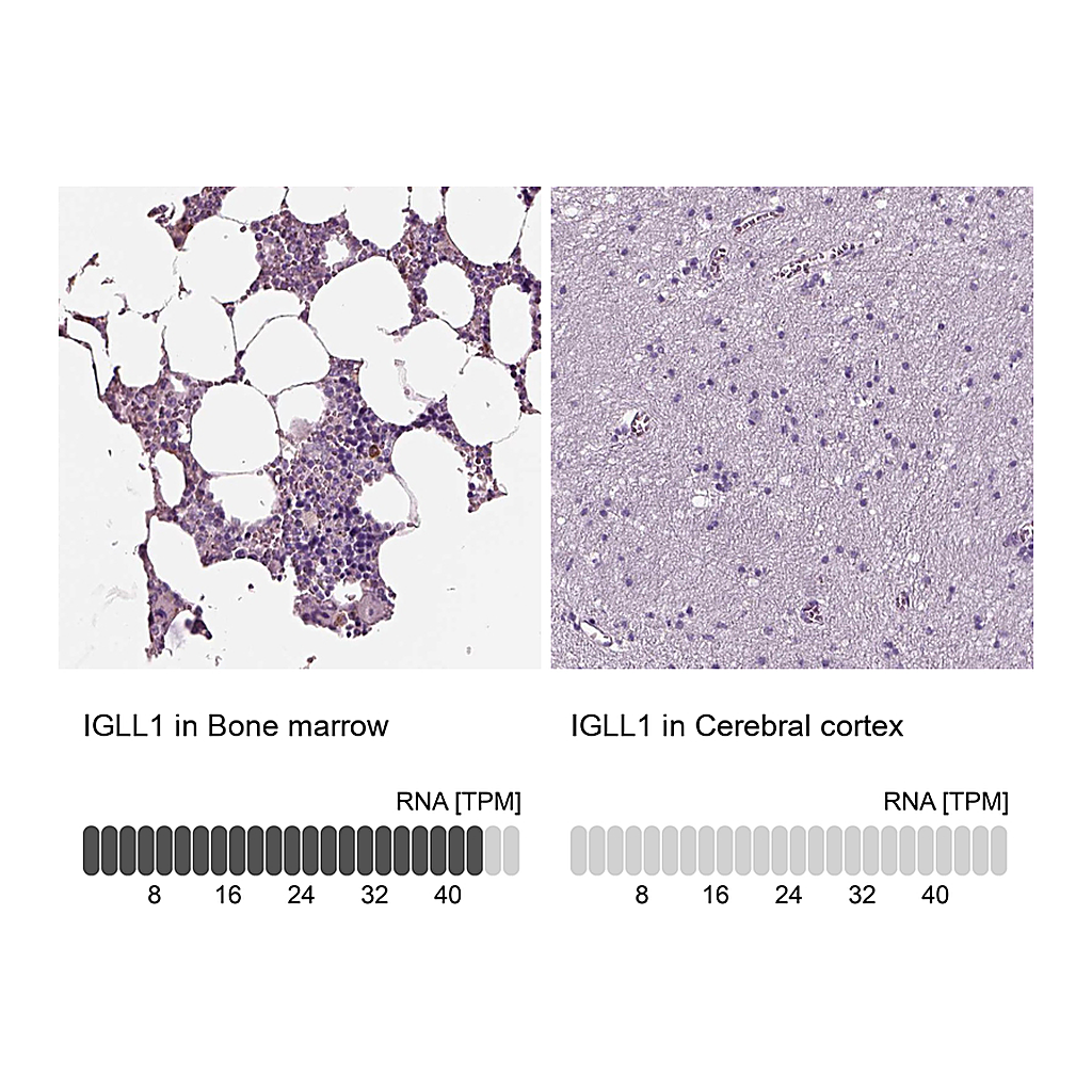 Atlas Antibodies Anti-IGLL1 Antibody