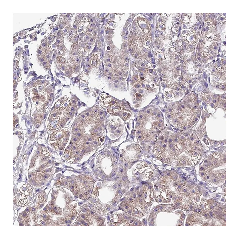 Atlas Antibodies Anti-IGIP Antibody