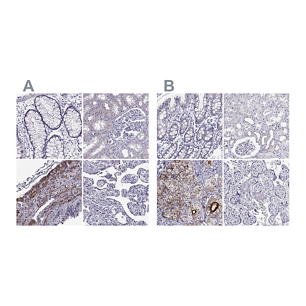 Atlas Antibodies Anti-IGSF1 Antibody