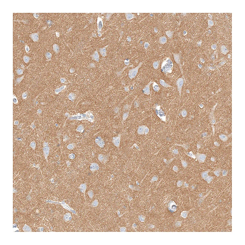 Atlas Antibodies Anti-IGSF21 Antibody