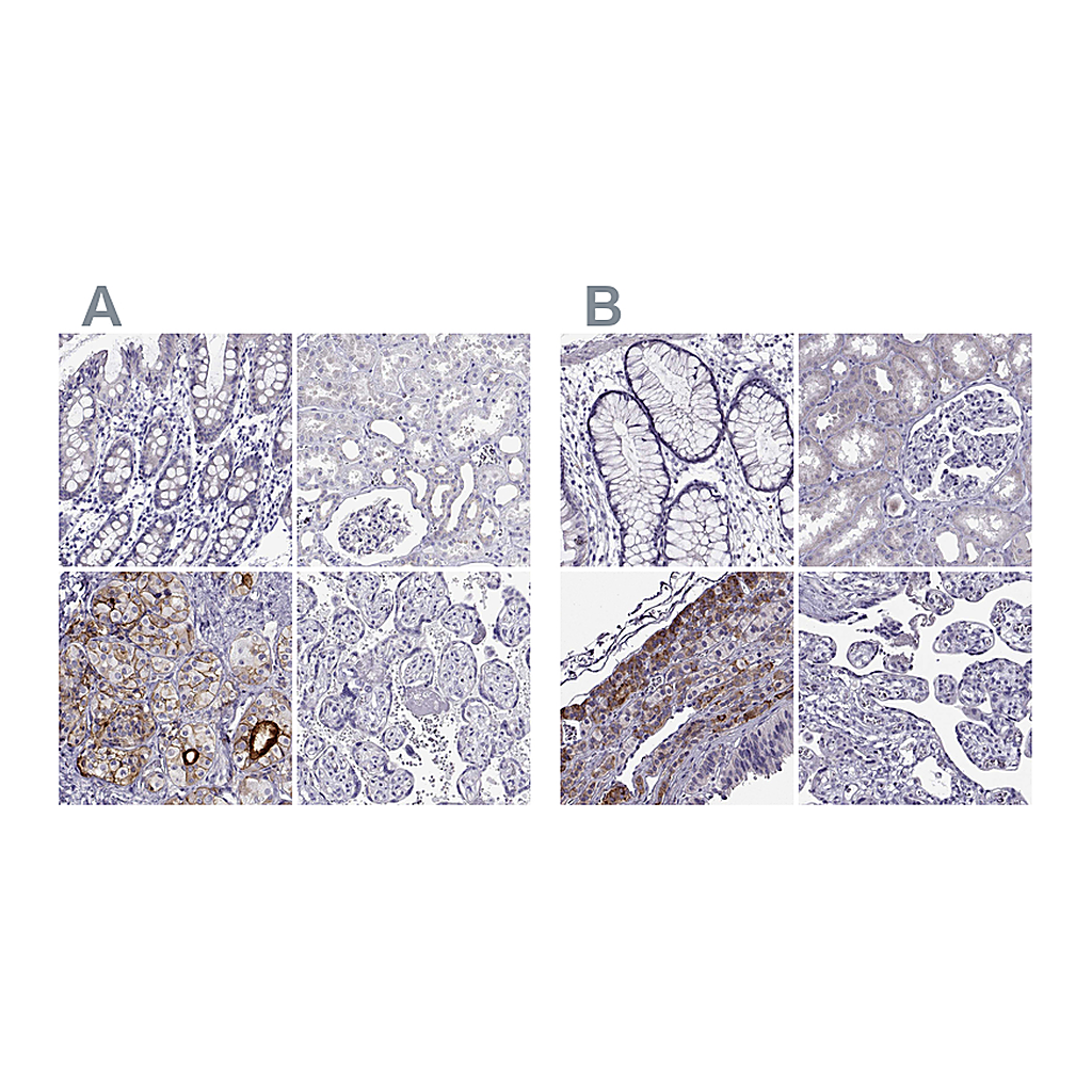 Atlas Antibodies Anti-IGSF1 Antibody