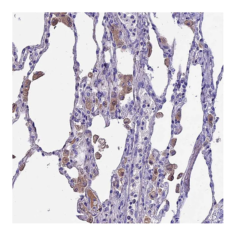 Atlas Antibodies Anti-IGSF6 Antibody