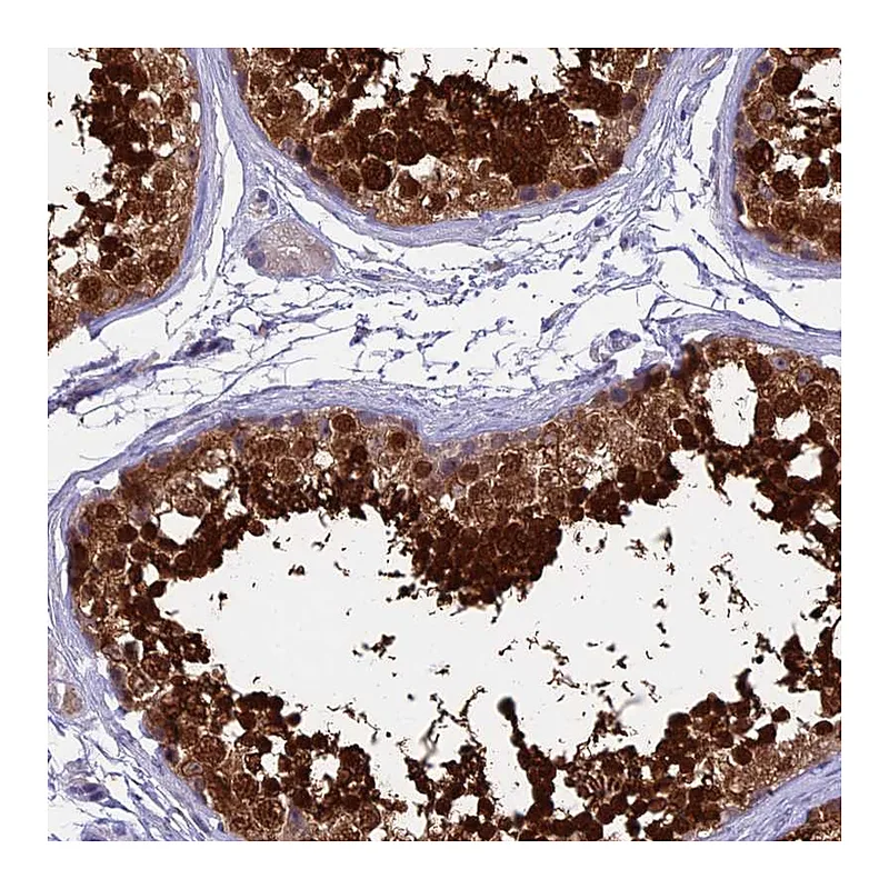 Atlas Antibodies Anti-IGSF6 Antibody