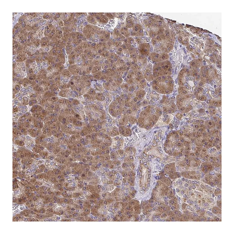Atlas Antibodies Anti-IKBKAP Antibody