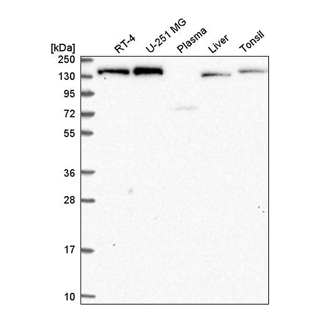 Atlas Antibodies Anti-IKBKAP Antibody