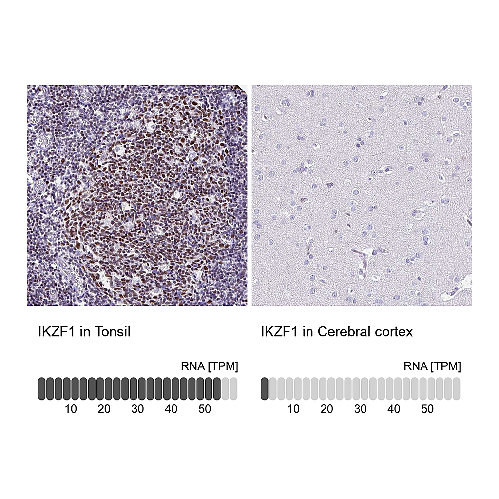 Atlas Antibodies Anti-IKZF1 Antibody