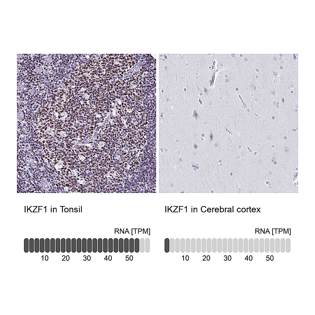 Atlas Antibodies Anti-IKZF1 Antibody