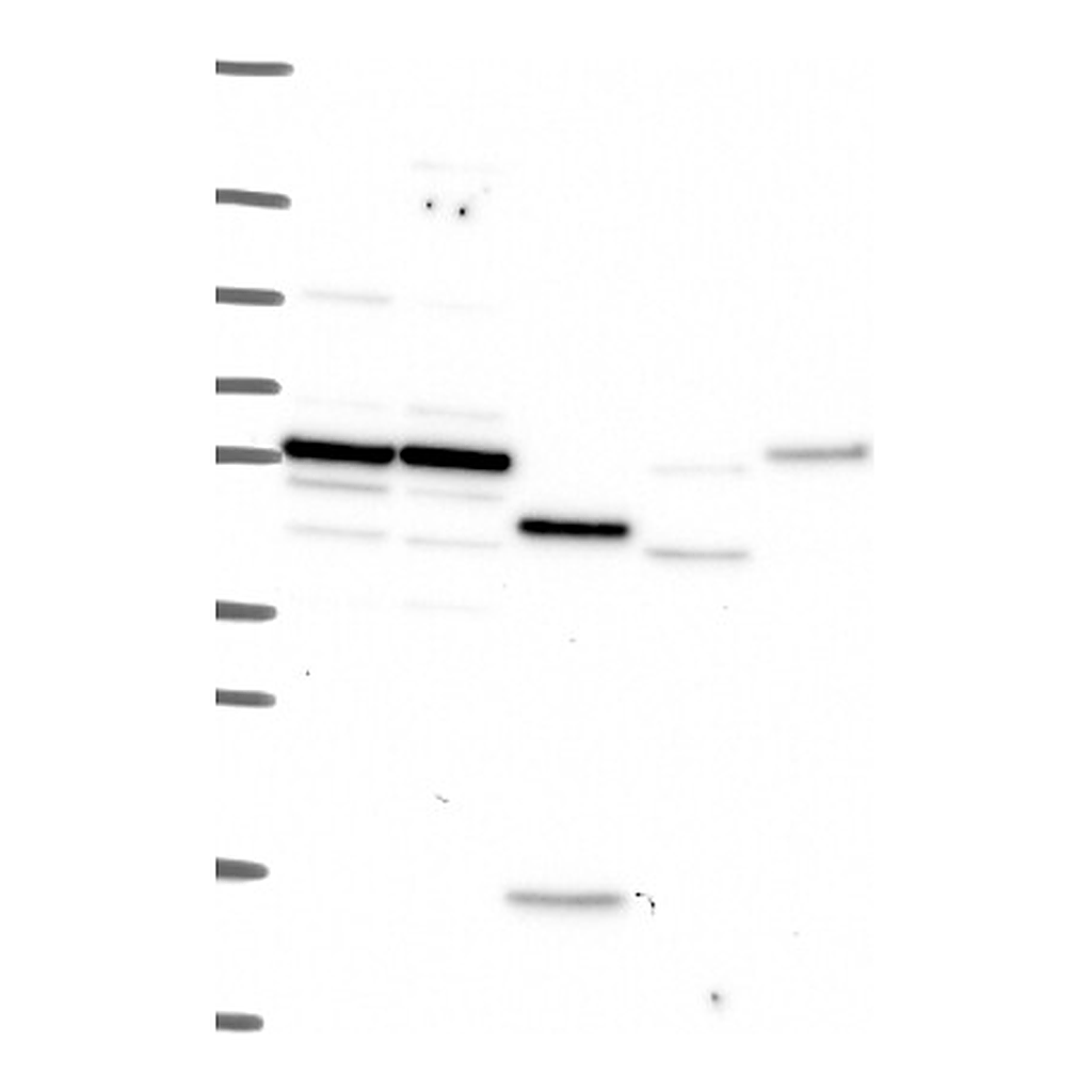 Atlas Antibodies Anti-IL10RA Antibody