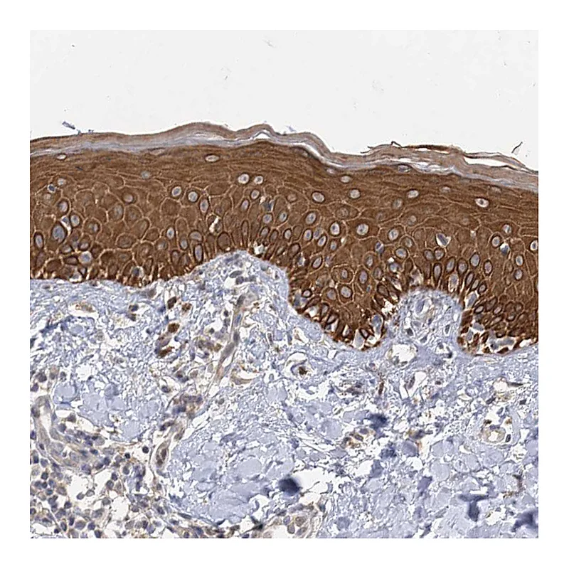 Atlas Antibodies Anti-IL11RA Antibody
