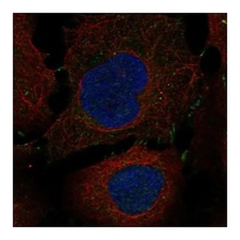 Atlas Antibodies Anti-IL13RA2 Antibody