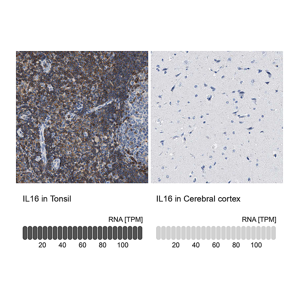 Atlas Antibodies Anti-IL16 Antibody