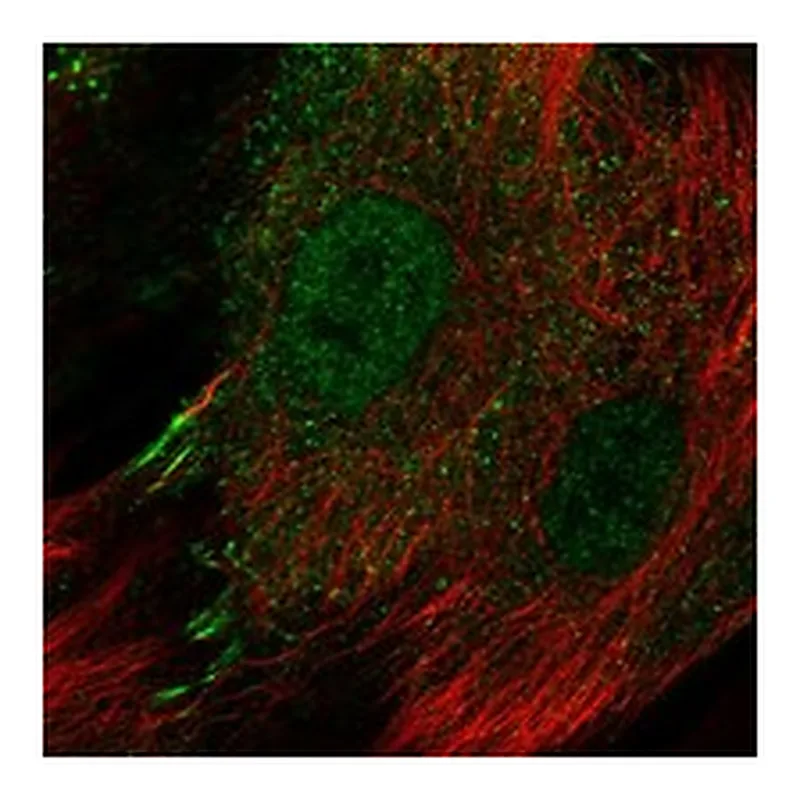 Atlas Antibodies Anti-IL13RA2 Antibody