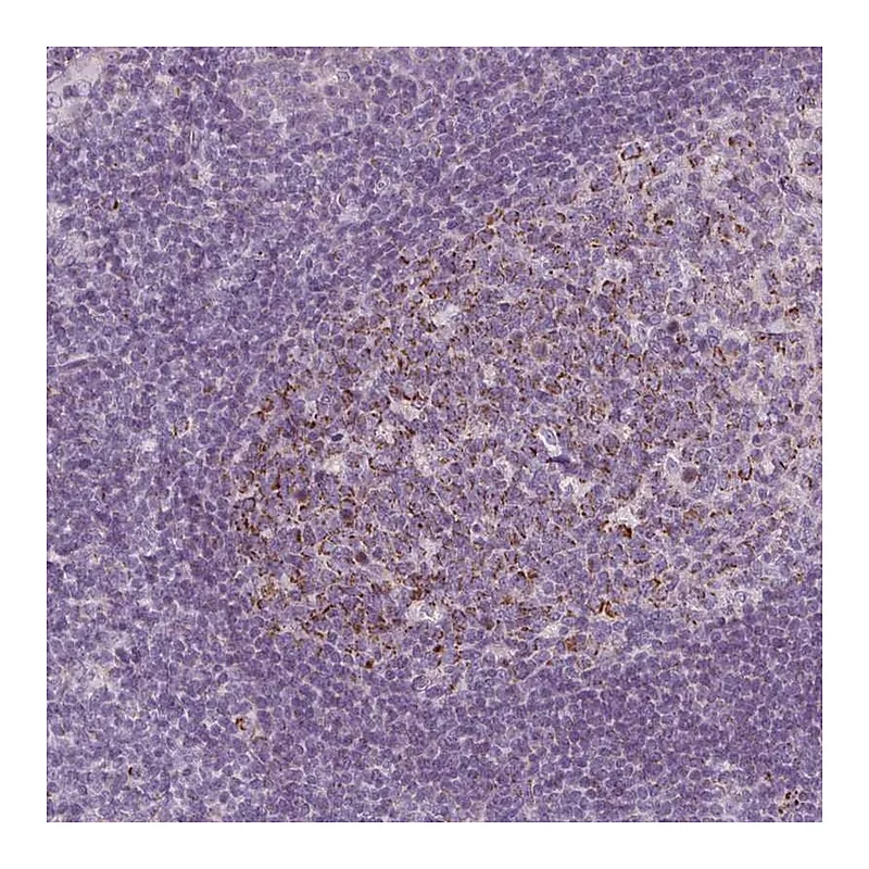 Atlas Antibodies Anti-IL17C Antibody