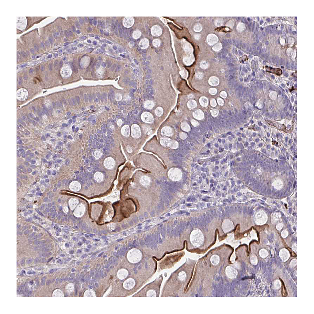 Atlas Antibodies Anti-IL1R1 Antibody