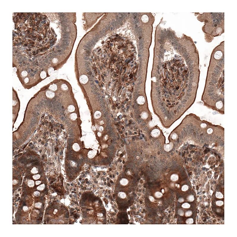Atlas Antibodies Anti-IL17RE Antibody