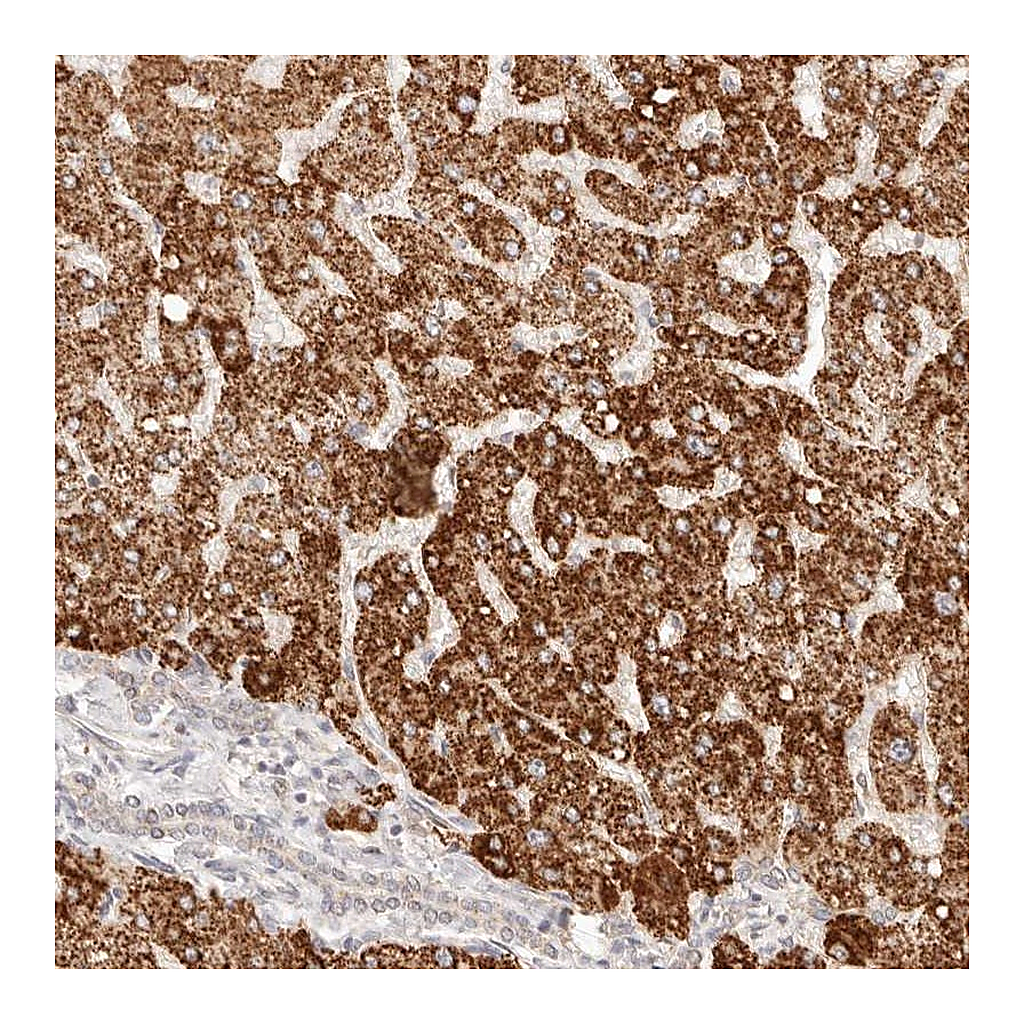 Atlas Antibodies Anti-IL1R2 Antibody