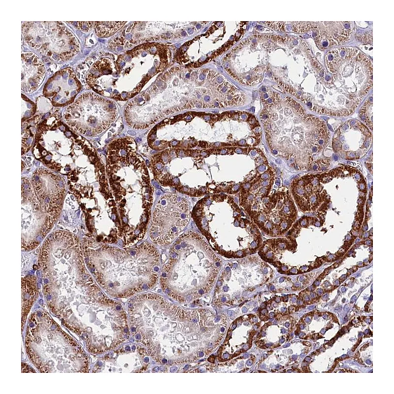Atlas Antibodies Anti-IL20RA Antibody