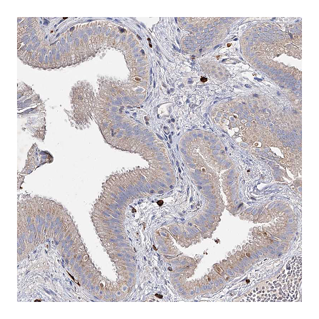 Atlas Antibodies Anti-IL1RAP Antibody