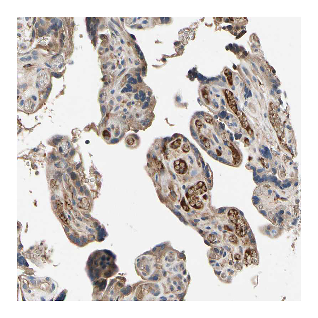 Atlas Antibodies Anti-IL1RL1 Antibody