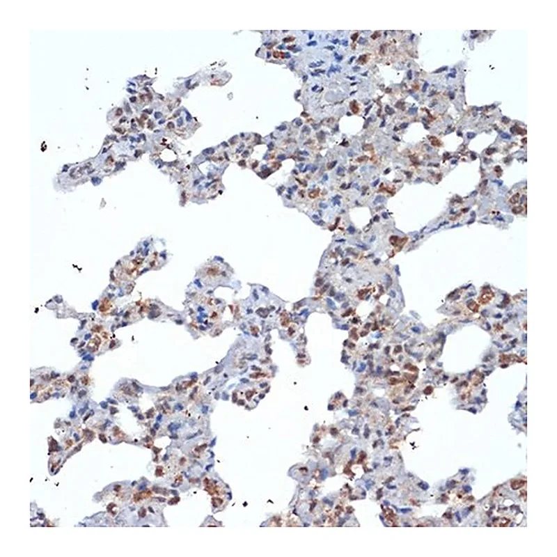 Merck Anti-SOCS2 antibody produced in rabbit