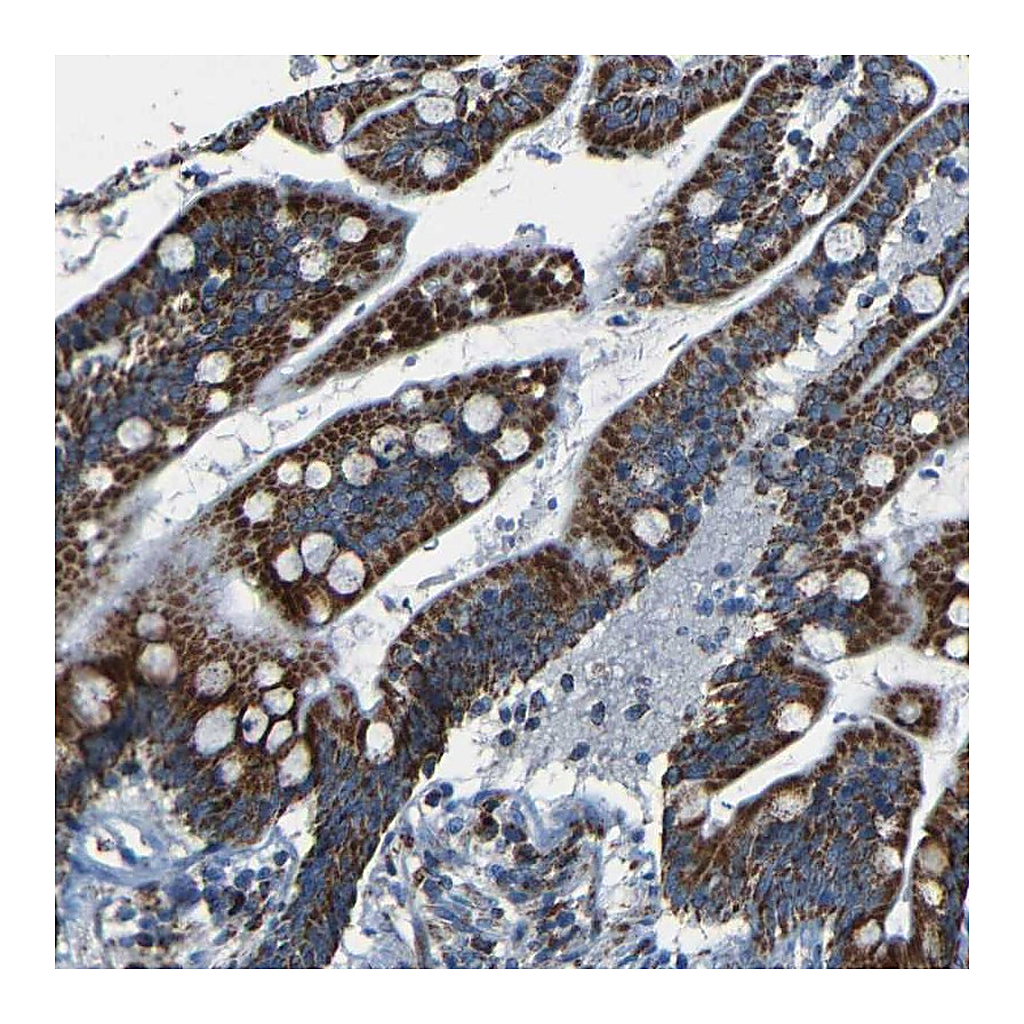 Atlas Antibodies Anti-WSCD2 Antibody