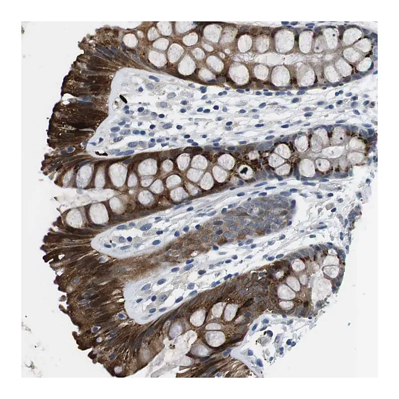 Atlas Antibodies Anti-WSCD1 Antibody