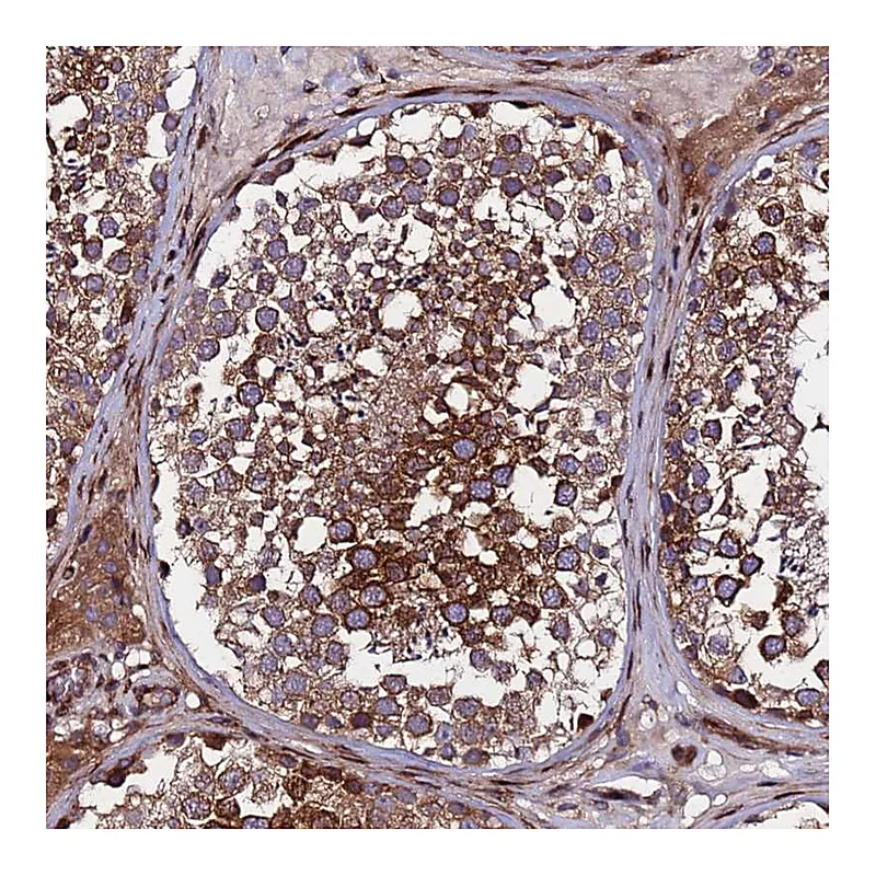 Atlas Antibodies Anti-WWC2 Antibody